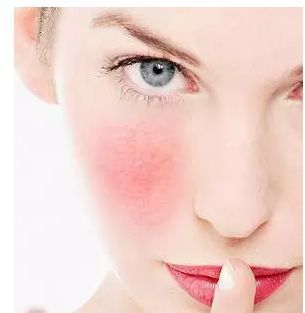 拿什么拯救你，紅血絲小姐