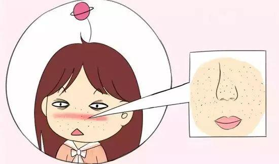 女生毛孔粗大到底應(yīng)該怎么辦？