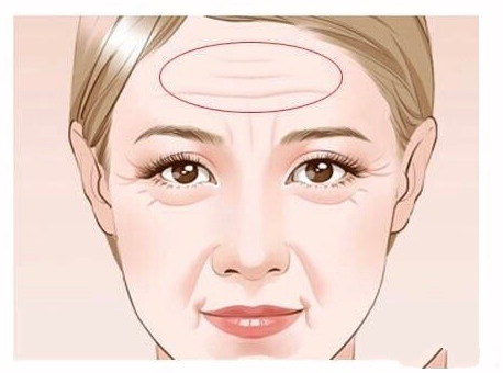 ?年紀(jì)輕輕?有了抬頭紋？